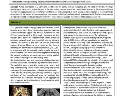 Endovascular approach to Aortic Coarctation