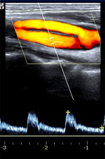 Ultraschalluntersuchung